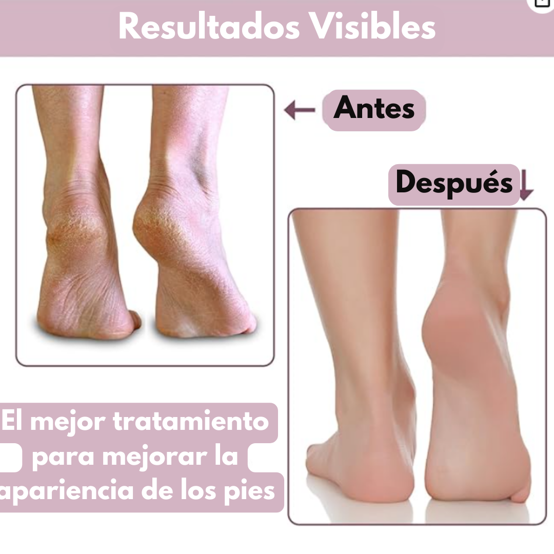 Tus PIES HIDRATADOS por MAS TIEMPO ¡Lleva 2 PARES de MEDIAS HIDRANTES por el precio de 1! OFERTA POR TIEMPO LIMITADO