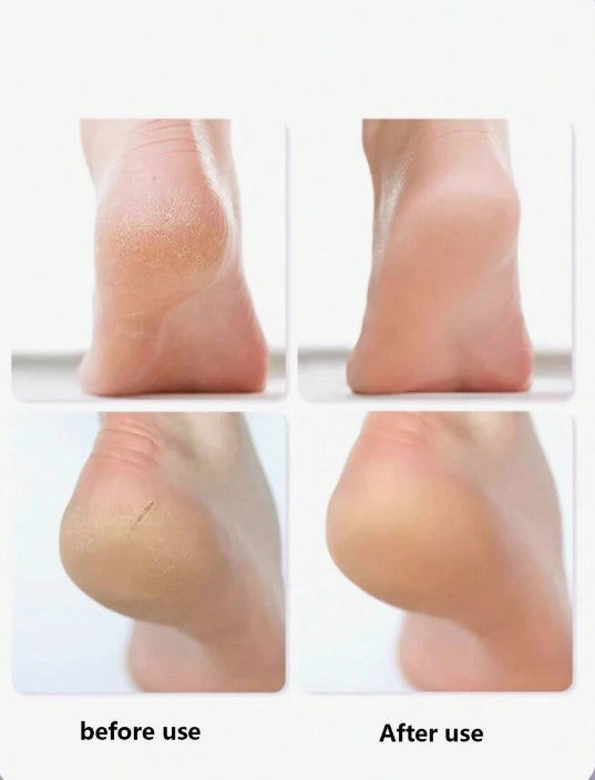 Tus PIES HIDRATADOS por MAS TIEMPO ¡Lleva 2 PARES de MEDIAS HIDRANTES por el precio de 1! OFERTA POR TIEMPO LIMITADO