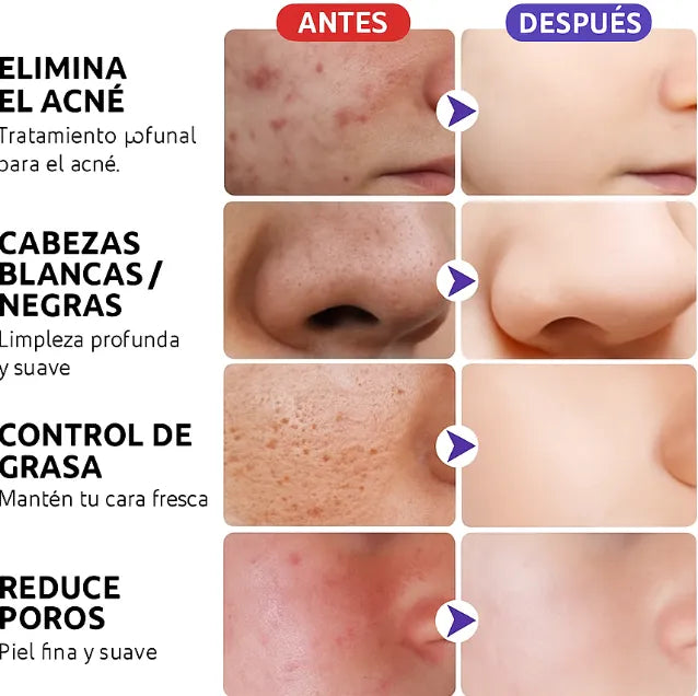 Mascarilla en barra: Green Stick. ENRIQUECIDA con Té Verde (OFERTA 2X1 🎁)