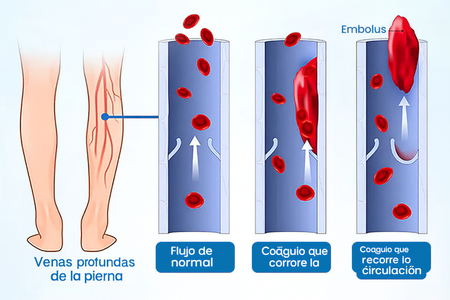 El Spray Mágico para Várices que Colombia Estaba Esperando + Guía Gratis para Piernas Sanas y Ligeras